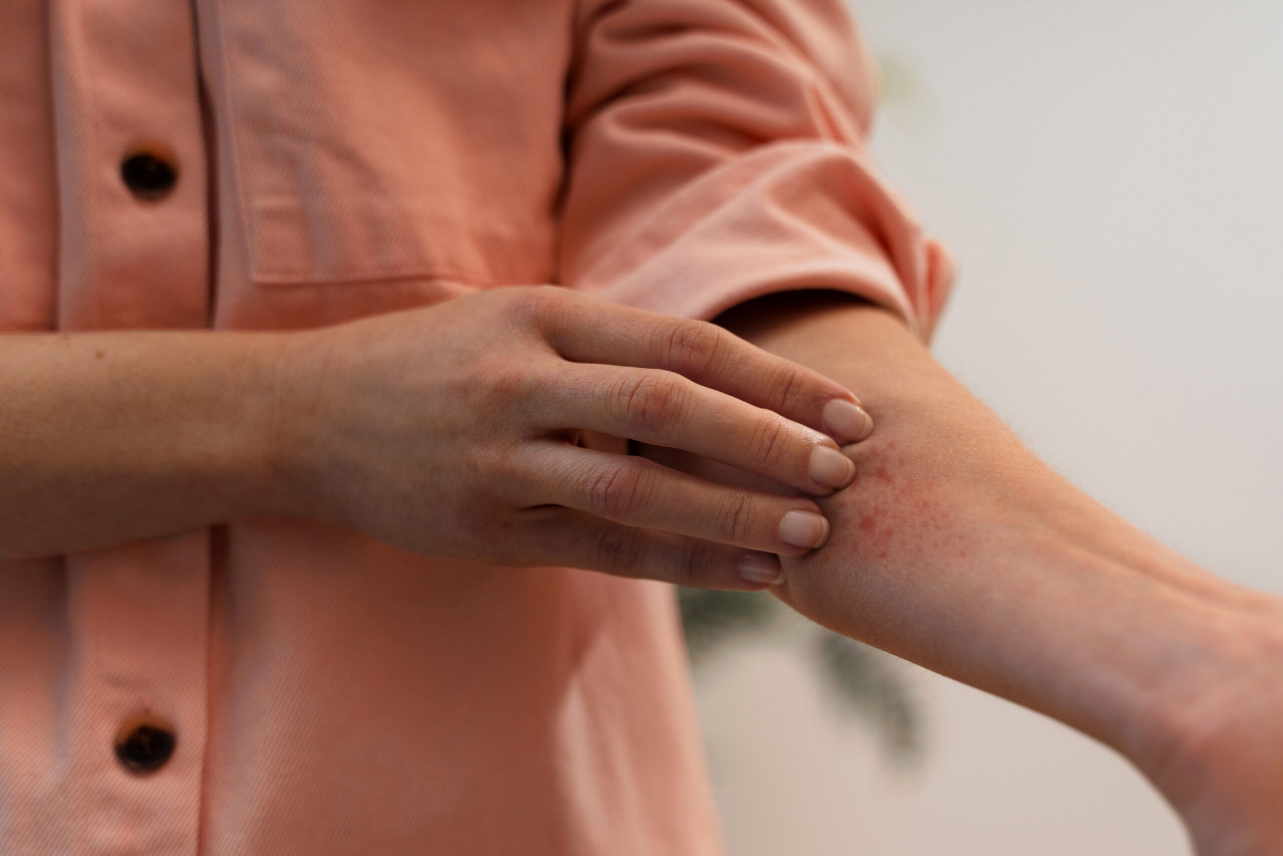 itchy skin autoimmune disease