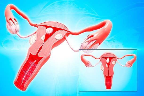 how to shrink uterine fibroids naturally